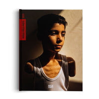 Das Buchcover von World Press Photo 2025 zeigt das Porträt eines Jungen ohne Arme in einem weißen Unterhemd, dessen Gesicht halb im Schatten und halb im hellen Sonnenlicht liegt, während er nachdenklich zur Seite blickt.